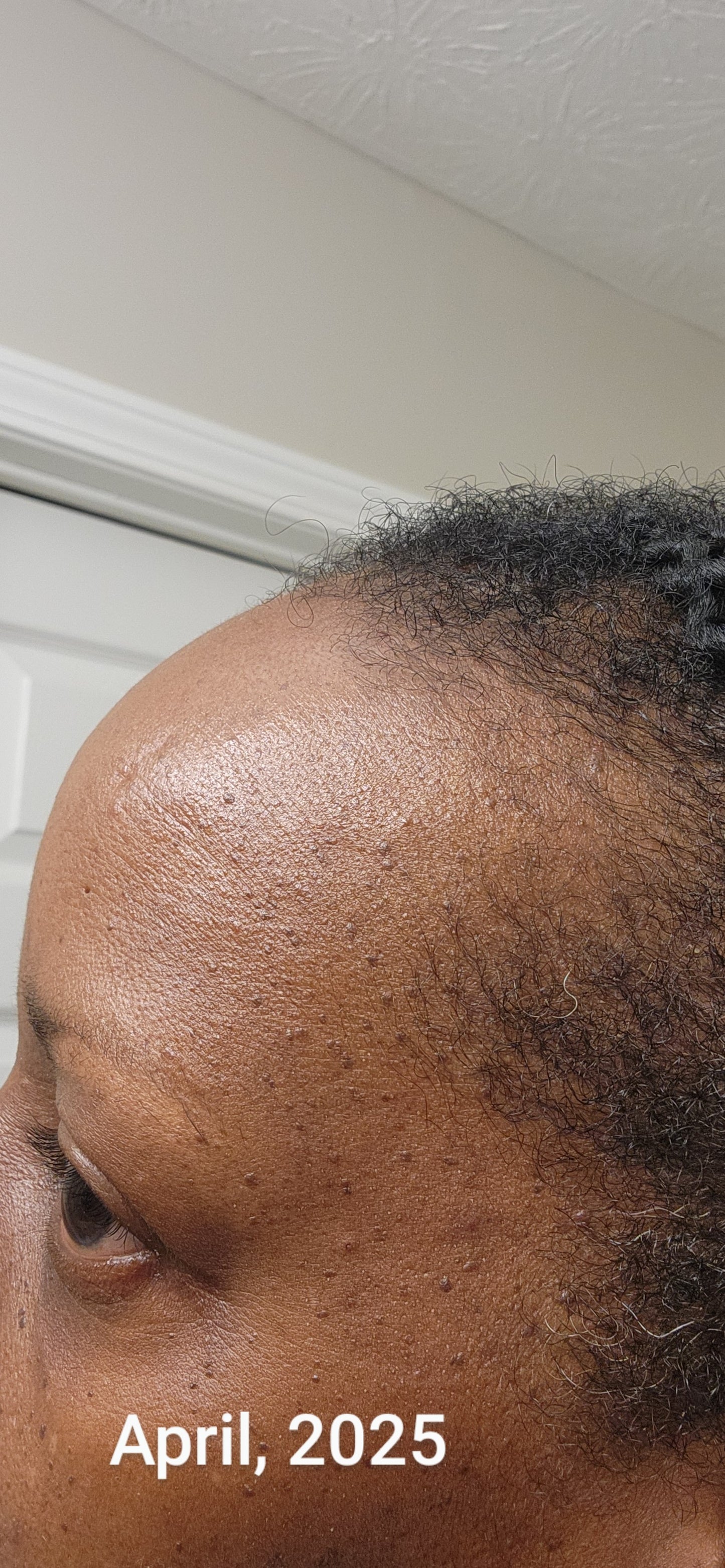 Mom's Hair Growth Oil
