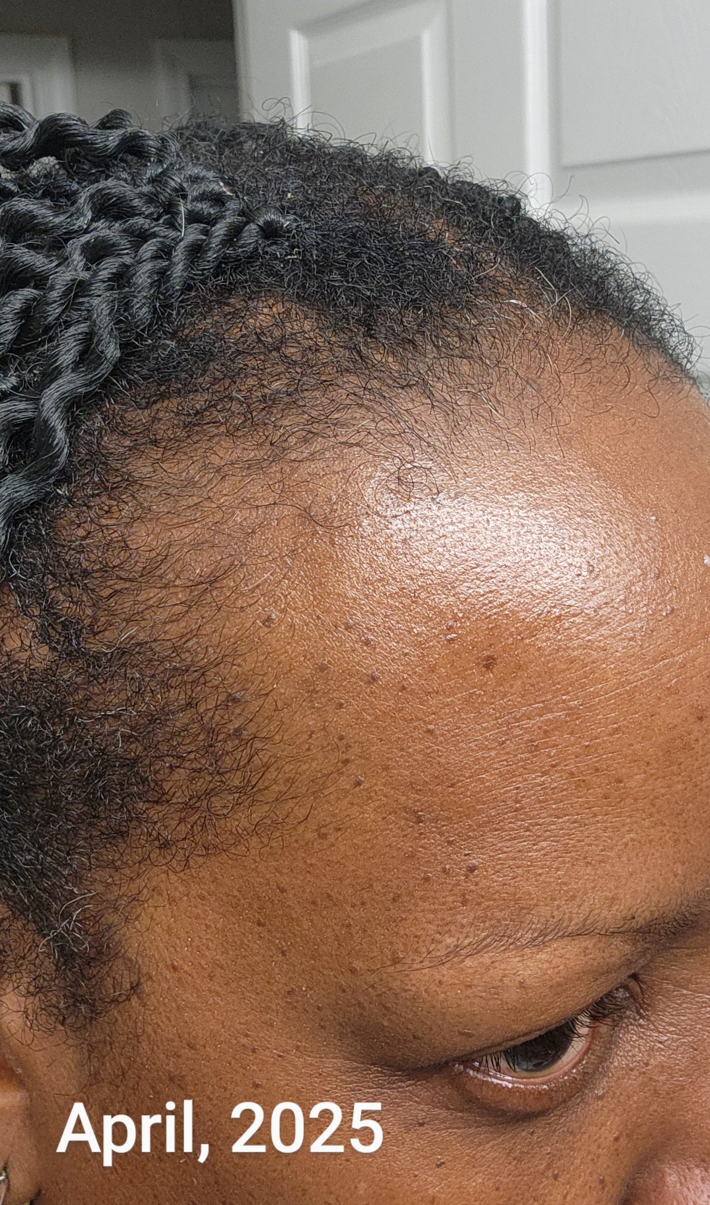 Mom's Hair Growth Oil