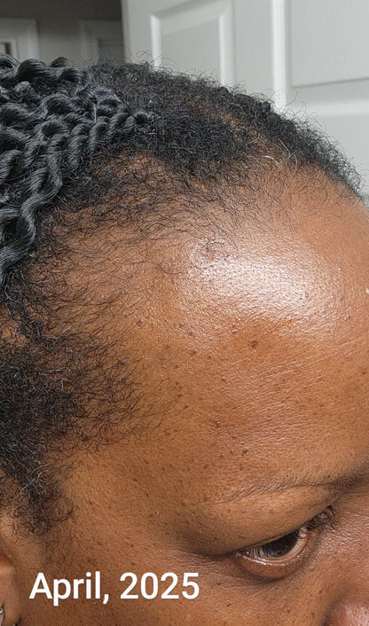 Mom's Hair Growth Oil